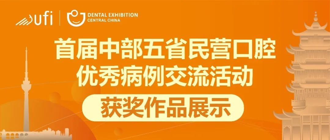 优秀病例合集第10期｜首届中部五省民营口腔优秀病例交流活动获奖作品展示（美学修复篇）