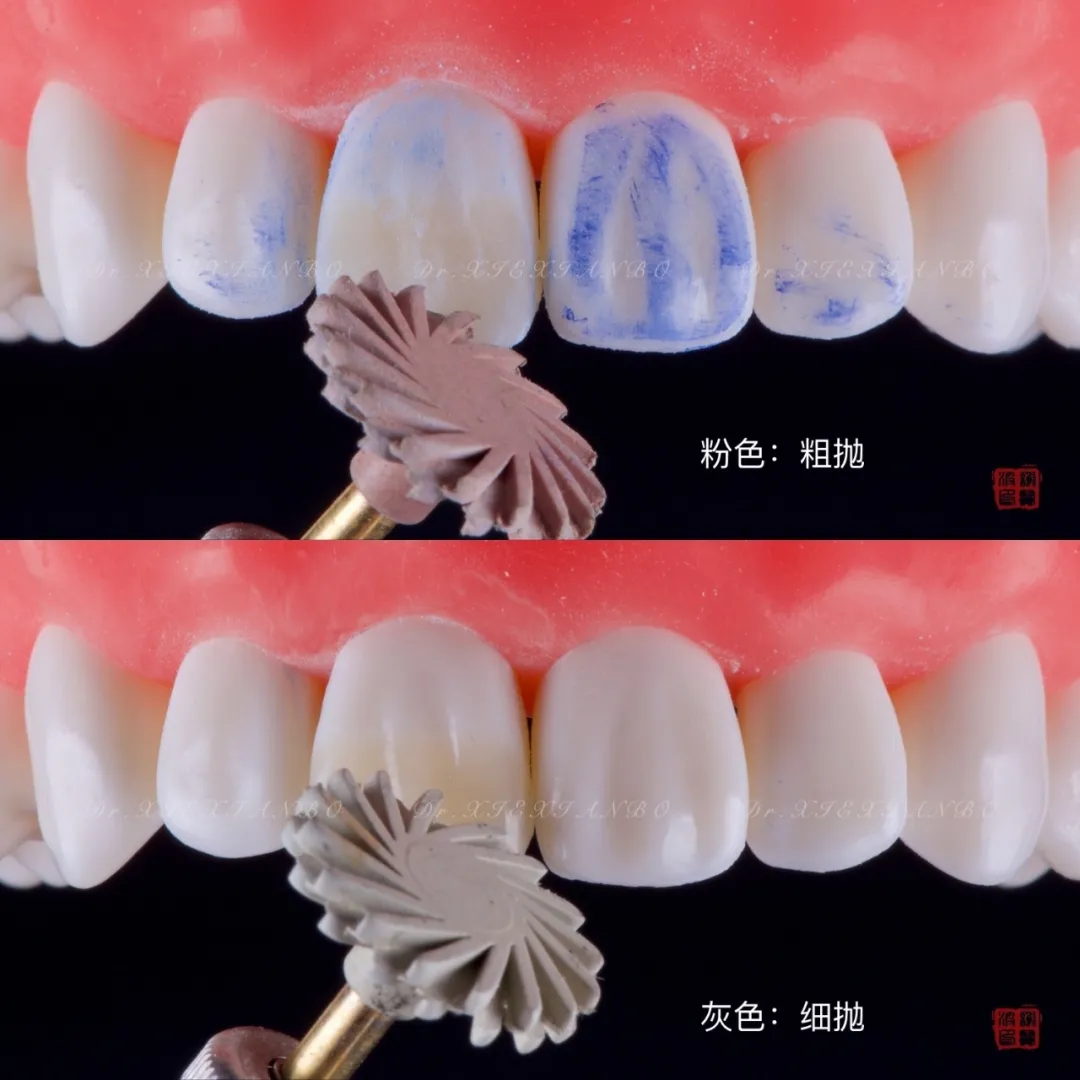 牙科玻璃离子怎么去除材料集中采购，来10月上海口腔展！ ｜ 诊室材料产品预览-第三期_https://www.jmylbn.com_新闻资讯_第9张